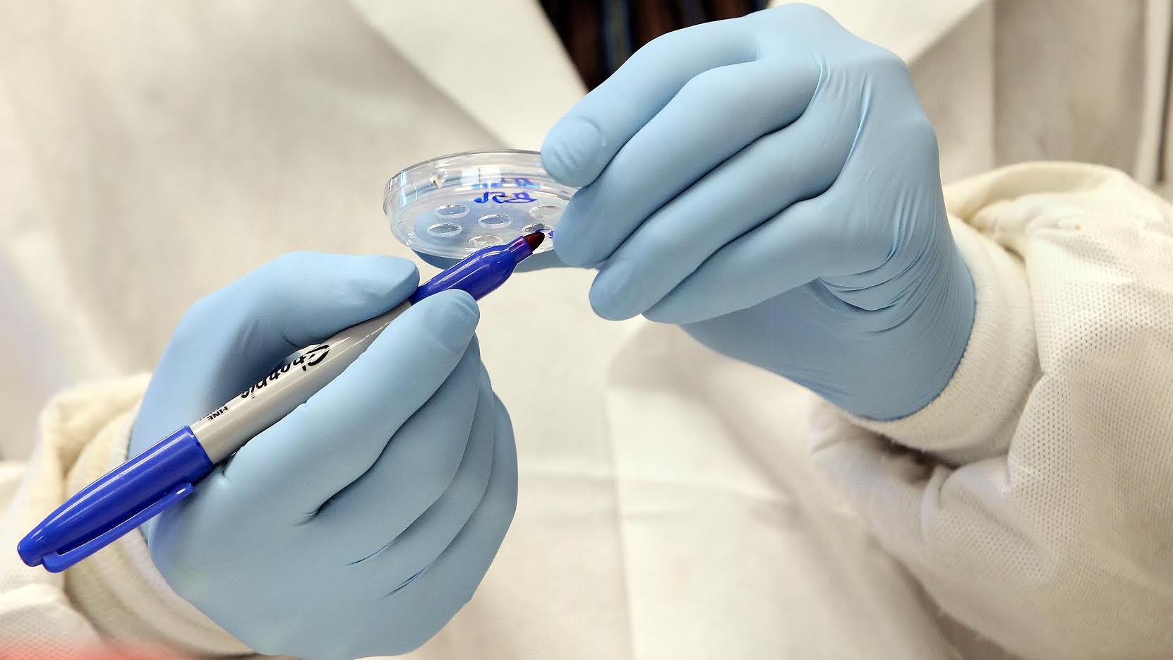 Valley fever cases rising in Arizona — doctors, patients should be on lookout